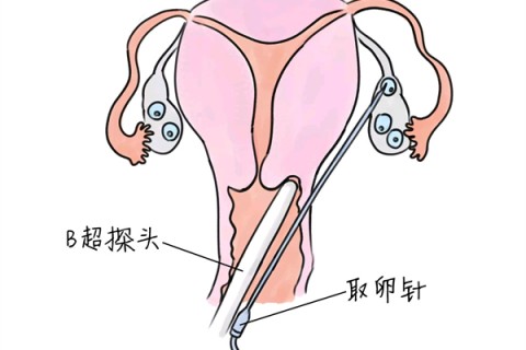 http://www.bytld.cn/post/191.html|试管助孕
